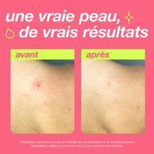 Charger l'image dans la galerie, Clarifying Bacne Spray