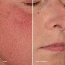 Charger l'image dans la galerie, Stabilizing repair cream