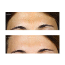 Charger l'image dans la galerie, POWERBRIGHT DARK SPOT SERUM