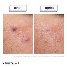 Charger l'image dans la galerie, breakout clearing liquid peel